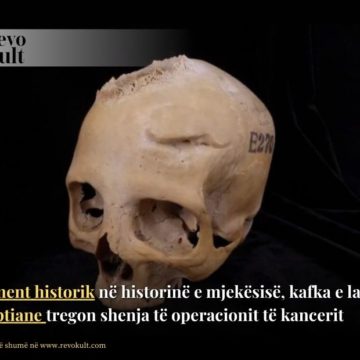 Moment historik në historinë e mjekësisë, kafka e lashtë egjiptiane tregon shenja të operacionit të kancerit