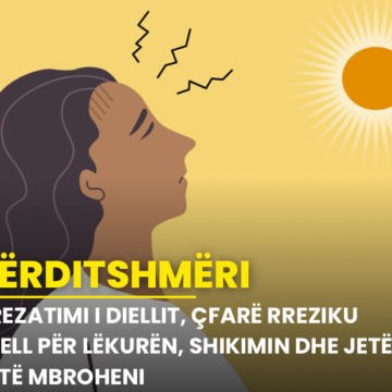 Rrezatimi i diellit, çfarë rreziku sjell për lëkurën, shikimin dhe jetën! Si të mbroheni