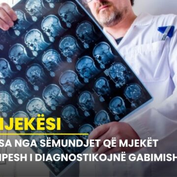 Disa nga sëmundjet që mjekët shpesh i diagnostikojnë gabimisht