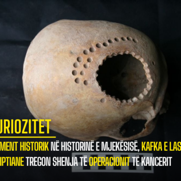 Moment historik në historinë e mjekësisë, kafka e lashtë egjiptiane tregon shenja të operacionit të kancerit