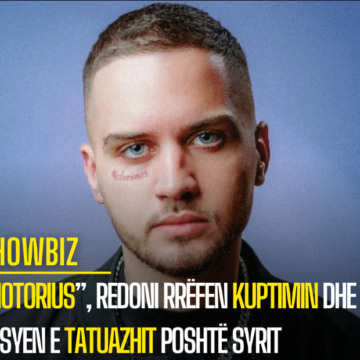 “Notorius”, Redoni rrëfen kuptimin dhe arsyen e tatuazhit poshtë syrit