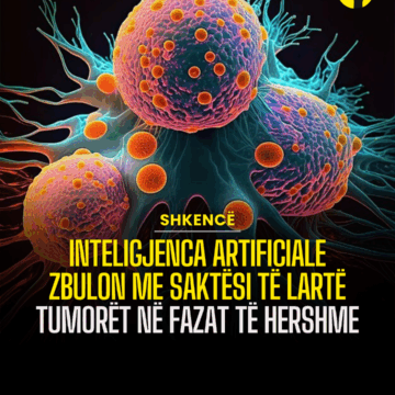 Inteligjenca artificiale zbulon me saktësi të lartë tumorët në fazat të hershme