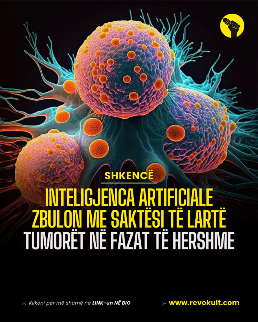 Inteligjenca artificiale zbulon me saktësi të lartë tumorët në fazat të hershme