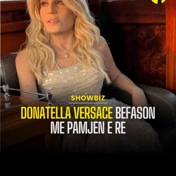 Donatella Versace befason me pamjen e re, stilistja ‘zhbën’ ndërhyrjet plastike në fytyrë