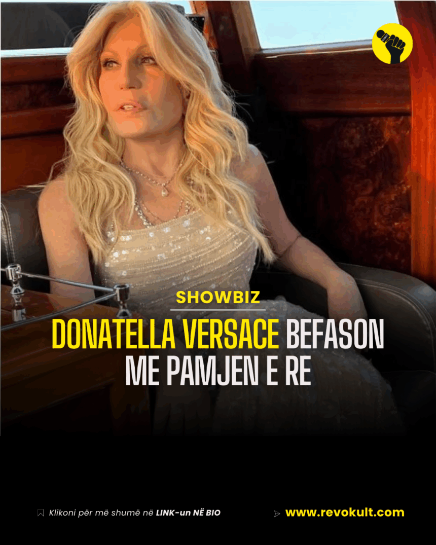 Donatella Versace befason me pamjen e re, stilistja ‘zhbën’ ndërhyrjet plastike në fytyrë