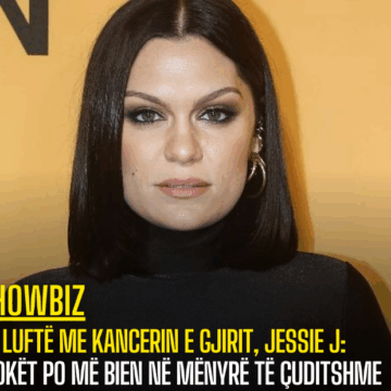 Në luftë me kancerin e gjirit, Jessie J: Flokët po më bien në mënyrë të çuditshme