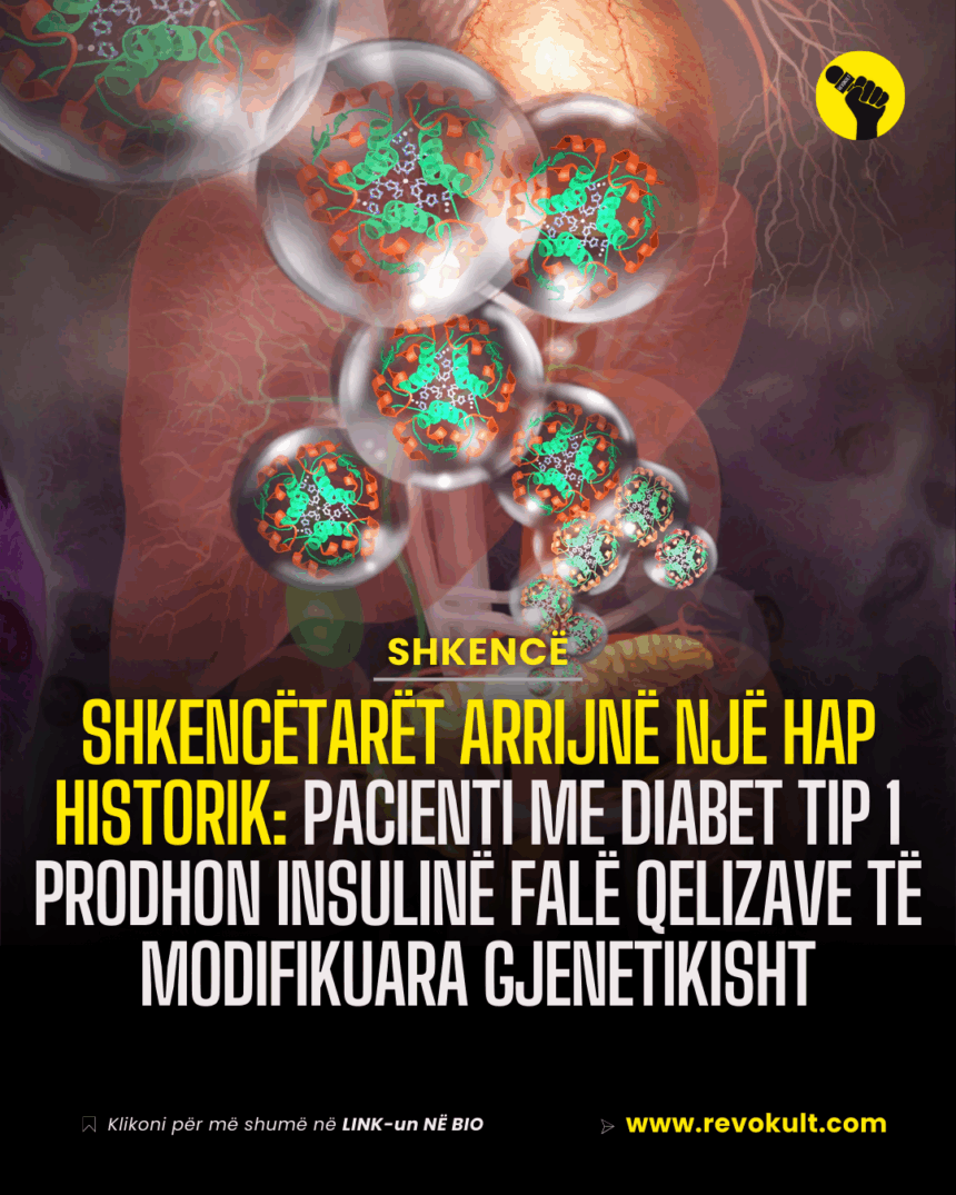 Shkencëtarët arrijnë një hap historik: Pacienti i parë me diabet tip 1 prodhon insulinë falë qelizave të modifikuara gjenetikisht